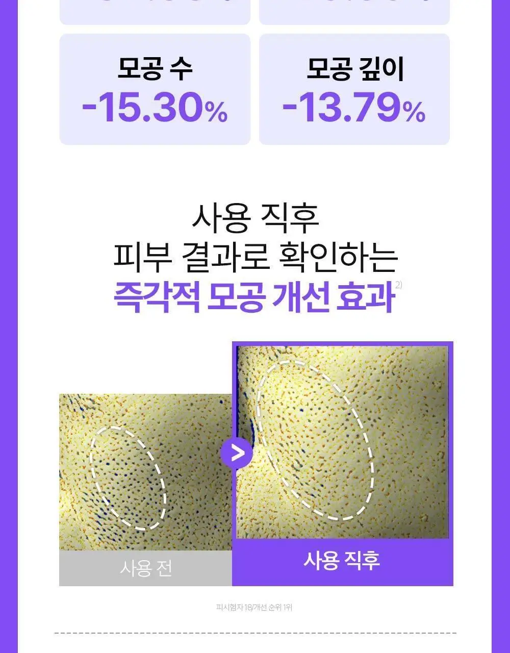 [잡티케어] 더마펌 수딩 리페어 토닝 세럼 R4 30ml 기획 (+리필 30ml) 상세페이지 30